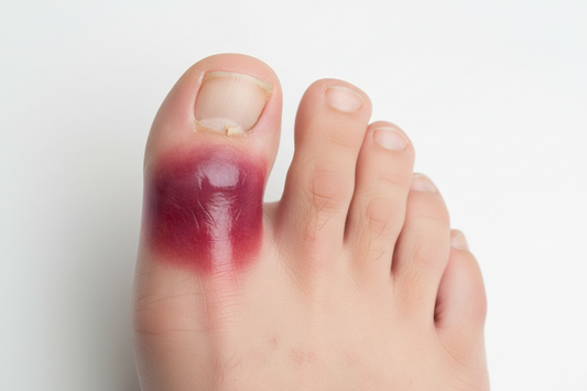 Guide complet sur l'orteil gonflé rouge douloureux : Causes, traitements et conseils