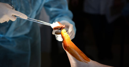 Comment choisir des chaussures orthopédiques adaptées après une opération ?