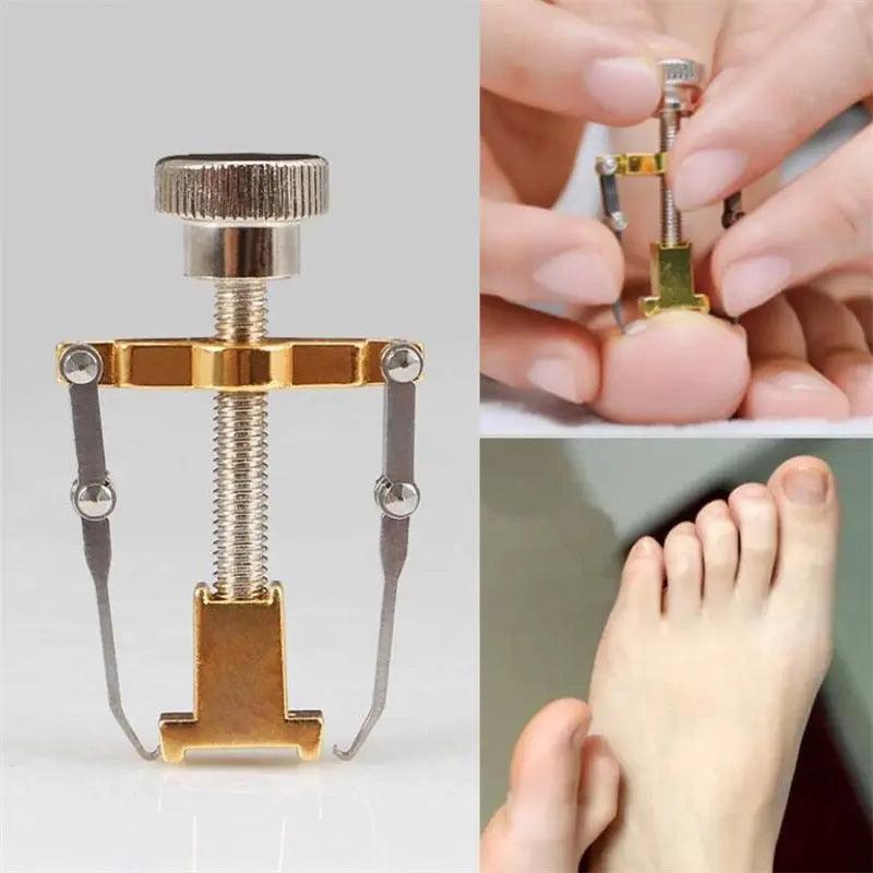 Correcteur d'ongles incarnés - Confort Orthopédique