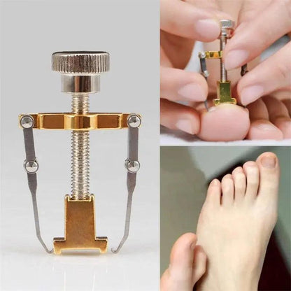 Correcteur d'ongles incarnés - Confort Orthopédique