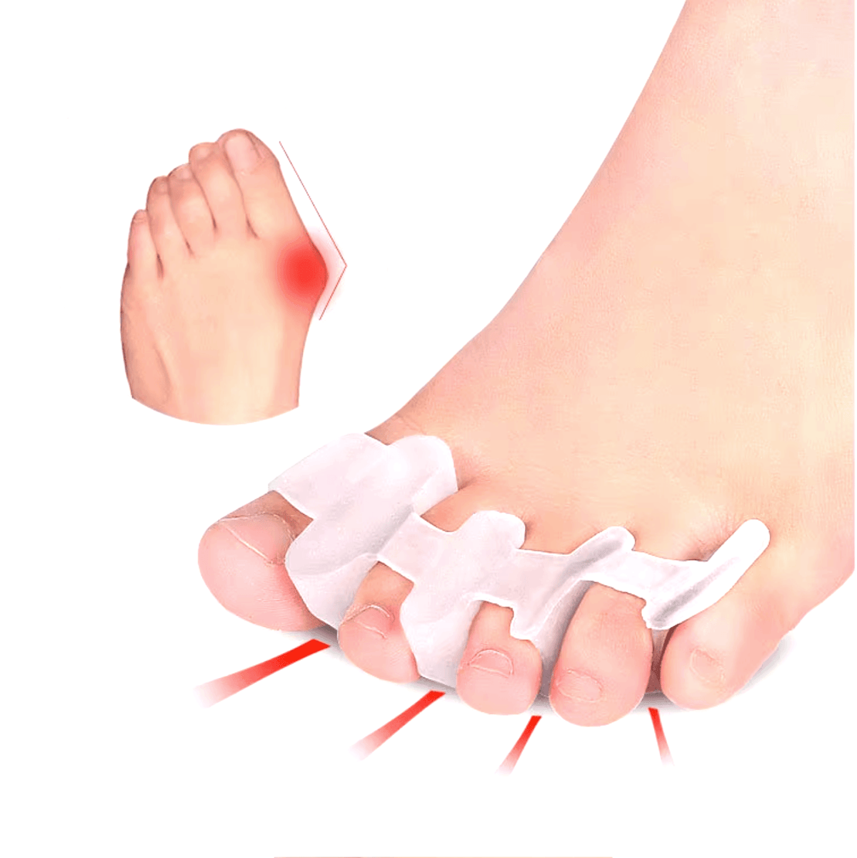 Orthèse orteil en griffe - Confort Orthopédique