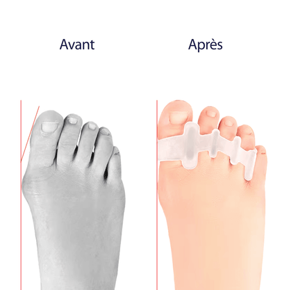 Orthèse orteil en griffe - Confort Orthopédique