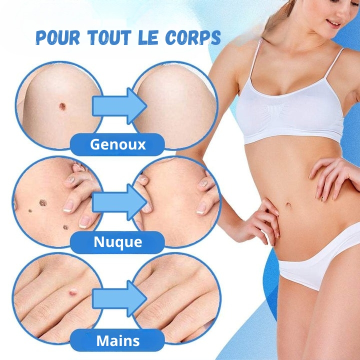 Kit traitement des verrues