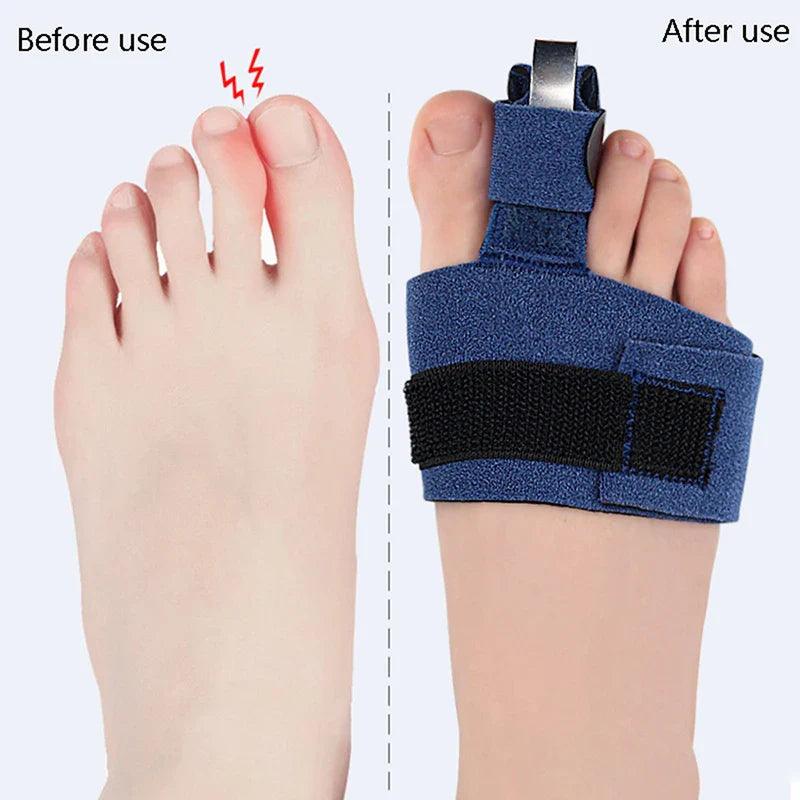 Orthèse doigt de pied - Confort Orthopédique