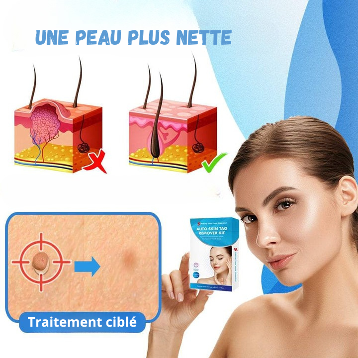 Kit traitement des verrues