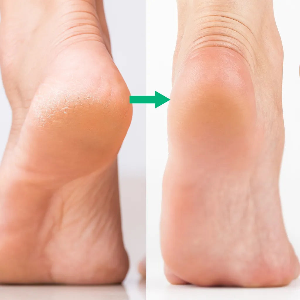 Râpe électrique pour pieds professionnelle - Image 3